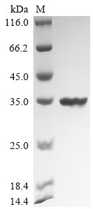 Greater than 90% as determined by SDS-PAGE.Recombinant Bacillus Velezensis Ucmb5033 Chitosanase (CSN) Protein (His)