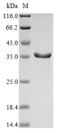 Greater than 90% as determined by SDS-PAGE.Recombinant Apis Mellifera Venom Dipeptidyl Peptidase 4 Protein (His&Myc)