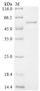 Greater than 85% as determined by SDS-PAGE.Recombinant Clostridium Tetani Tetanus Toxin Protein (His-SUMO)