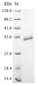 Greater than 85% as determined by SDS-PAGE.Recombinant Clostridium Tetani Tetanus Toxin Protein (His)