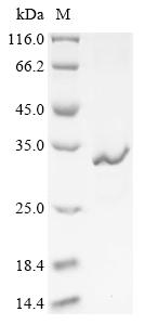 Greater than 90% as determined by SDS-PAGE.Recombinant Clostridium Tetani Tetanus Toxin Protein (His)