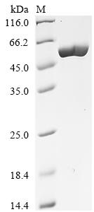 Greater than 85% as determined by SDS-PAGE.Recombinant Clostridium Tetani Tetanus Toxin Protein (His)