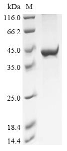 Greater than 90% as determined by SDS-PAGE.Recombinant Klebsiella Pneumoniae Phosphoethanolamine--Lipid A Transferase Mcr-8.1 (MCR-8) Protein (His)