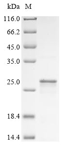 Greater than 95% as determined by SDS-PAGE.Recombinant Mouse Neutrophilic Granule Protein (NGP) Protein (His)