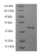 Greater than 90% as determined by SDS-PAGE.Recombinant Rotavirus A Non-Structural Glycoprotein 4 (NSP4) Protein (His-SUMO)