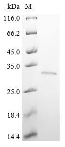 Greater than 90% as determined by SDS-PAGE.Recombinant Human Brca1-Associated Protein (BRAP) Protein (GST)