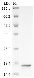 Greater than 85% as determined by SDS-PAGE.Recombinant Human T Cell Receptor Beta Variable 19 (TRBV19) Protein (His)