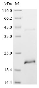 Greater than 90% as determined by SDS-PAGE.