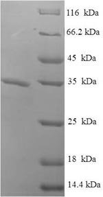 Greater than 90% as determined by SDS-PAGE.