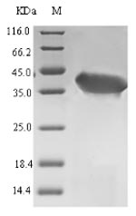 Greater than 90% as determined by SDS-PAGE.Recombinant Laribacter Hongkongensis Orotate Phosphoribosyltransferase (PYRE) Protein (His-SUMO)