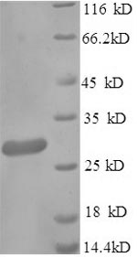 Greater than 90% as determined by SDS-PAGE.Recombinant Klebsiella Pneumoniae Metallo-Beta-Lactamase Type 2 (BLANDM-1) Protein (His-SUMO)