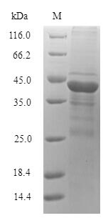 Greater than 90% as determined by SDS-PAGE.Recombinant Microbacterium Testaceum N-Acyl Homoserine Lactonase (AIIM) Protein (His-SUMO)