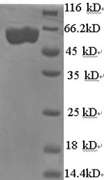 Greater than 90% as determined by SDS-PAGE.Recombinant Shigella Flexneri Serotype X E3 Ubiquitin-Protein Ligase Ipah9.8 (IPAH9.8) Protein (His)