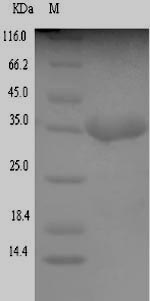 Greater than 90% as determined by SDS-PAGE.