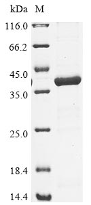 Greater than 85% as determined by SDS-PAGE.Recombinant Legionella Pneumophila Aspartate-Semialdehyde Dehydrogenase (ASD) Protein (His)