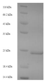 Greater than 90% as determined by SDS-PAGE.Recombinant Micrurus Tener Tener Kunitz-Type Neurotoxin Mittx-Alpha Protein (His-SUMO)