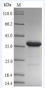 Greater than 90% as determined by SDS-PAGE.Recombinant Mycobacterium Tuberculosis Hypoxic Response Protein 1 (HRP1) Protein (His-SUMO&Myc)