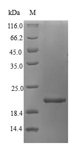 Greater than 90% as determined by SDS-PAGE.Recombinant Atlantic Salmon Vertebrate Ancient Opsinï¼ŒPartial Protein (His-B2M)