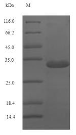 Greater than 90% as determined by SDS-PAGE.Recombinant Dog Major Allergen Can F 1 Protein (His-SUMO)