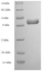 Greater than 90% as determined by SDS-PAGE.Recombinant Crotalus Adamanteus Thrombin-Like Enzyme Crotalase (SVTLE) Protein (His-SUMO)