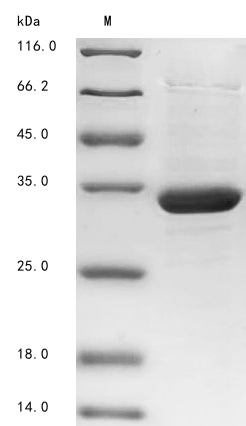 Greater than 85% as determined by SDS-PAGE.Recombinant Zaire Ebolavirus Membrane-Associated Protein Vp24 (VP24) Protein (His&Myc)