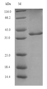 Greater than 85% as determined by SDS-PAGE.