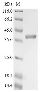 Greater than 90% as determined by SDS-PAGE.Recombinant Aquifex Aeolicus Reverse Gyrase 2 (RGY2) Protein (His&Myc)