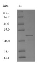 Greater than 90% as determined by SDS-PAGE.