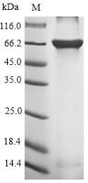 Greater than 90% as determined by SDS-PAGE.Recombinant Rabies Virus Glycoprotein (G) Protein (His-SUMO&Myc)