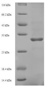 Greater than 90% as determined by SDS-PAGE.Recombinant Hepatitis B Virus Genotype D Protein X (X) Protein (His-SUMO)