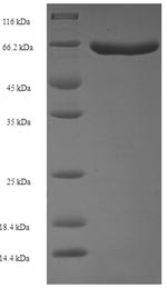 Greater than 90% as determined by SDS-PAGE.Recombinant Schizosaccharomyces Pombe Sulfide:Quinone Oxidoreductase, Mitochondrial (HMT2) Protein (His-SUMO)