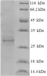 Greater than 90% as determined by SDS-PAGE.