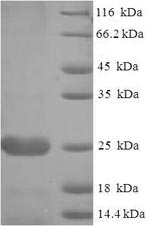 Greater than 90% as determined by SDS-PAGE.