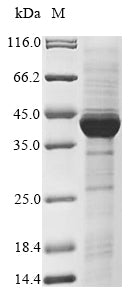 Greater than 85% as determined by SDS-PAGE.Recombinant Mouse 5-Amp-Activated Protein Kinase Subunit Gamma-1 (PRKAG1) Protein (His)