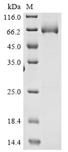 Greater than 85% as determined by SDS-PAGE.Recombinant Mouse High Affinity Cgmp-Specific 3,5-Cyclic Phosphodiesterase 9A (PDE9A) Protein (His)
