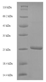Greater than 90% as determined by SDS-PAGE.Recombinant Human Scrapie-Responsive Protein 1 (SCRG1) Protein (His-SUMO)