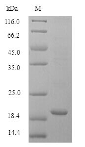 Greater than 90% as determined by SDS-PAGE.Recombinant Mouse Bis (FHIT) Protein (His)