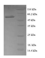 Greater than 90% as determined by SDS-PAGE.Recombinant E.Coli Ribose-5-Phosphate Isomerase A (RPIA) Protein (GST)