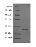 Greater than 90% as determined by SDS-PAGE.