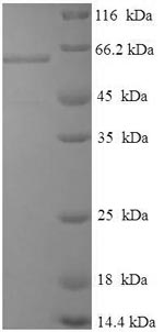 Greater than 90% as determined by SDS-PAGE.Recombinant Rotavirus A Intermediate Capsid Protein Vp6 Protein (His-SUMO)