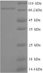 Greater than 90% as determined by SDS-PAGE.Recombinant Human Atp-Dependent Rna Helicase A (DHX9) Protein (His-SUMO)
