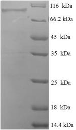 Greater than 90% as determined by SDS-PAGE.