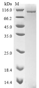 Greater than 85% as determined by SDS-PAGE.Recombinant Human Nuclear Cap-Binding Protein Subunit 1 (NCBP1) Protein (His&Myc)