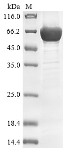 Greater than 85% as determined by SDS-PAGE.Recombinant Human Ap-1 Complex Subunit Beta-1 (AP1B1) Protein (His&Myc)
