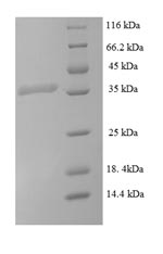 Greater than 90% as determined by SDS-PAGE.Recombinant Mycobacterium Tuberculosis Signal Peptidase I (LEPB) Protein (His-SUMO)