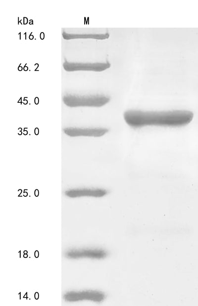 Greater than 85% as determined by SDS-PAGE.Recombinant Mouse Alpha- (FUT7) Protein (His)