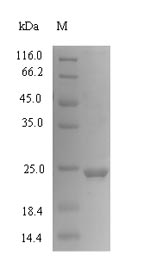 Greater than 90% as determined by SDS-PAGE.