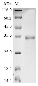 Greater than 90% as determined by SDS-PAGE.Recombinant Bat Coronavirus 133/2005 Spike Glycoprotein (S) Protein (His&Myc)