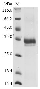 Greater than 85% as determined by SDS-PAGE.Recombinant Human Coronavirus Hku1 Spike Glycoprotein (S) Protein (His)