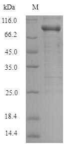 Greater than 90% as determined by SDS-PAGE.Recombinant Human Serine/Threonine-Protein Kinase Pak 1 (PAK1) Protein (His-SUMO)